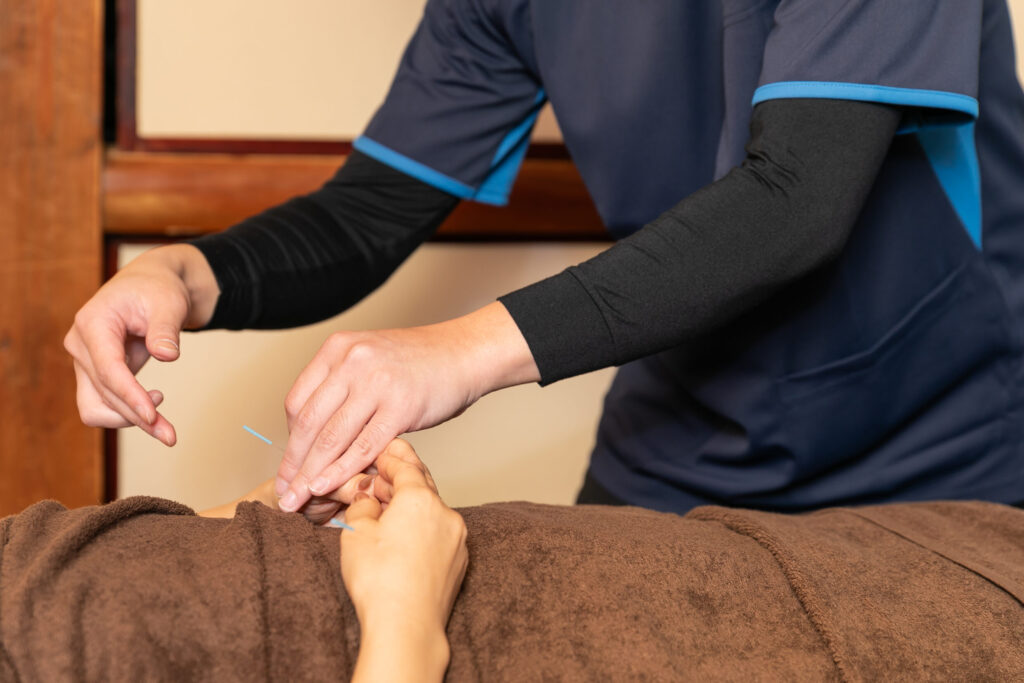 北千住 鍼灸 整体 自律神経 施術風景